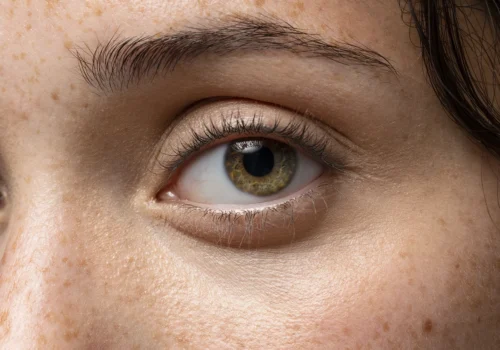 Podstawowy schemat pielęgnacji skóry z hiperpigmentacją od Circadia dla idealnego kolorytu twarzy i szyi