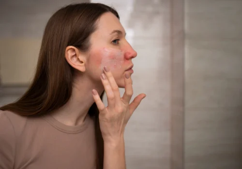 Jak odbudować skórę po oczyszczaniu: duet Circadia na zaczerwienienia